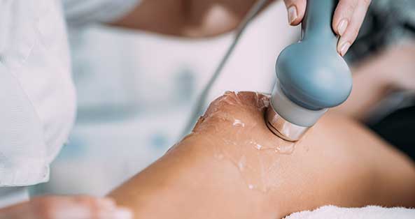 체외충격파 치료